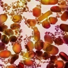 Imagem da notícia: Ouro poder&aacute; tratar cancro da pr&oacute;stata